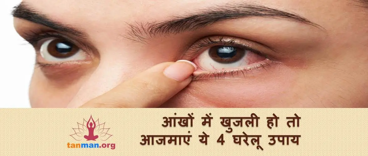 आंखों में खुजली हो रही हो तो आजमाएं ये 4 घरेलू उपाय