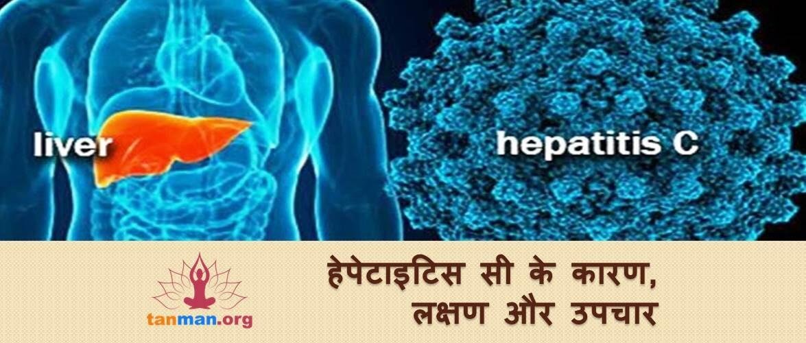 हेपेटाइटिस सी के कारण, लक्षण और उपचार