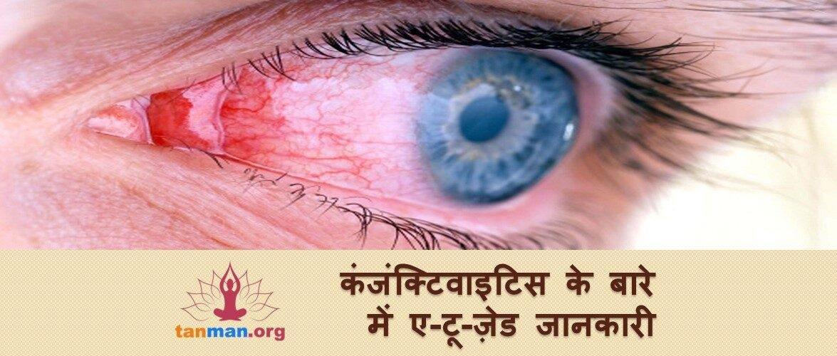 यहां पाएं कंजंक्टिवाइटिस के बारे में ए-टू-ज़ेड जानकारी