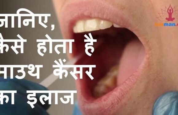 मुंह के कैंसर की सर्जरी के बारे में सब कुछ