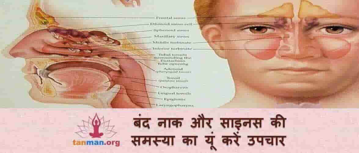 बंद नाक और साइनस की समस्या का यूं करें उपचार