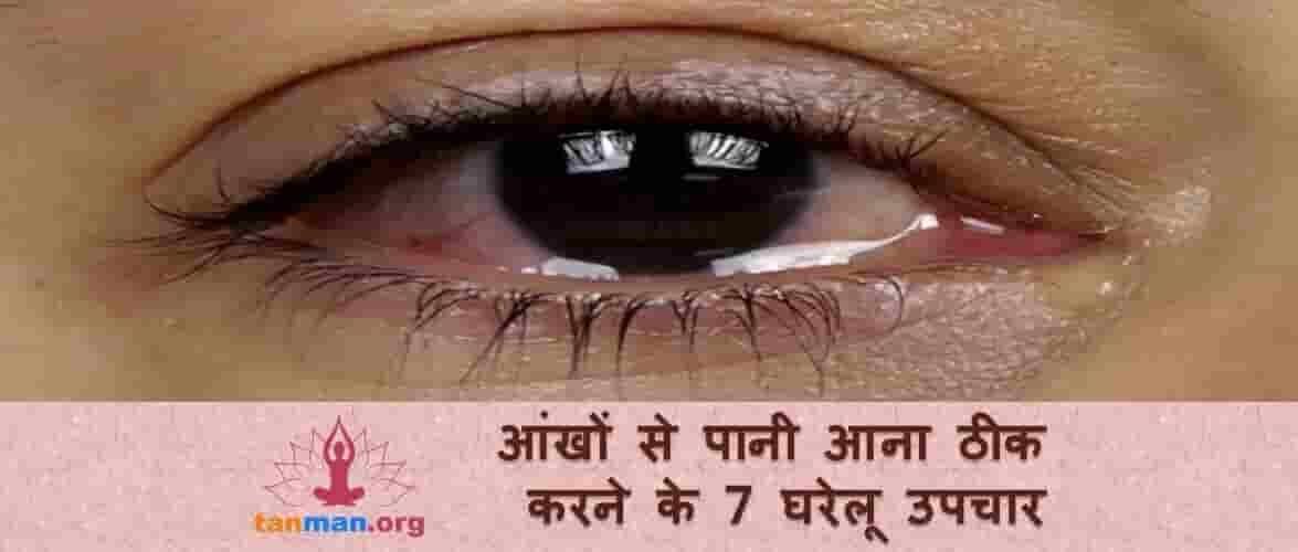 आंखों से पानी आ रहा हो तो इन 7 घरेलू उपायों से करें ठीक