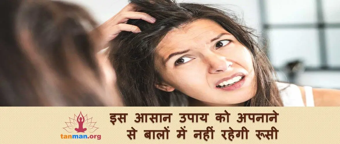बालों में रूसी की समस्या से इस तरह पाएं निजात