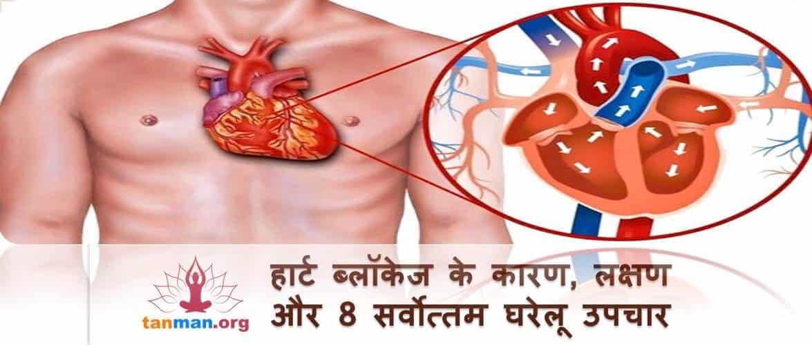 हार्ट ब्लॉकेज के कारण, लक्षण और टॉप 8 घरेलू उपचार