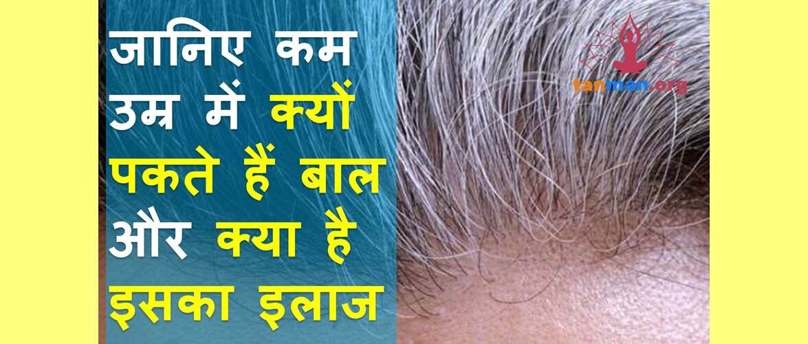 कम उम्र में क्यों पकते हैं बाल और क्या है इसका उपचार?