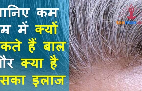कम उम्र में क्यों पकते हैं बाल और क्या है इसका उपचार?