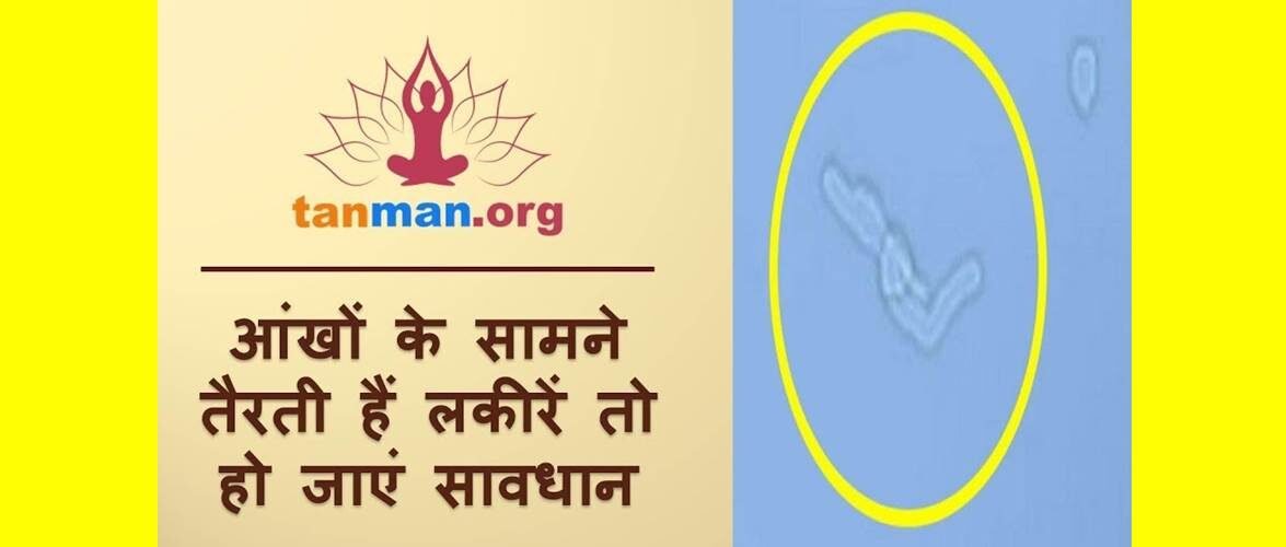 आंखों के सामने तैरते हैं फ्लोटर्स तो हो जाएं सावधान!