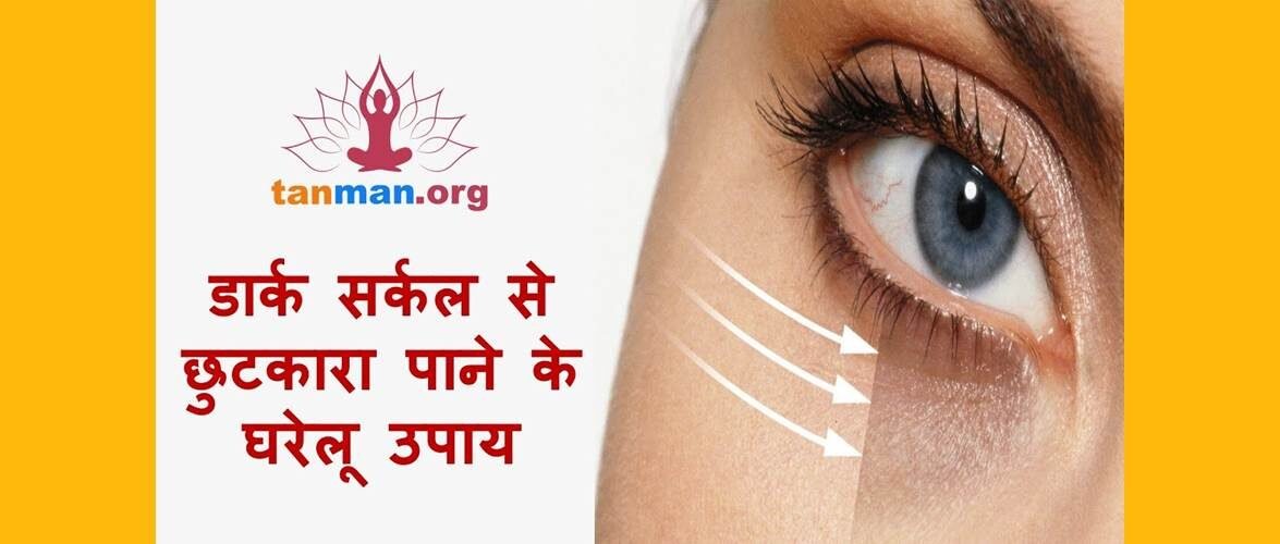 डार्क सर्कल हटाने के टॉप 7 घरेलू उपाय