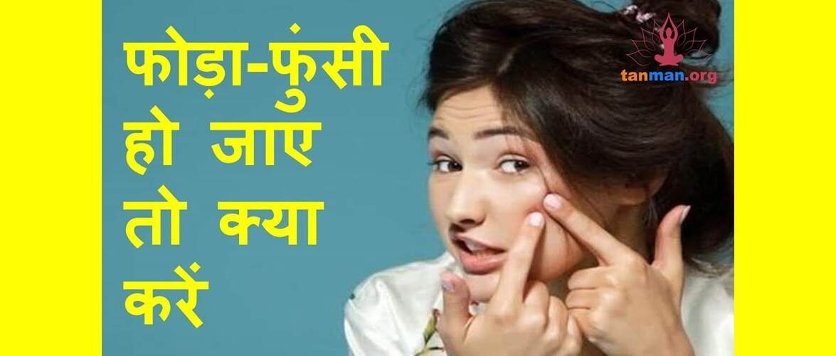 फोड़ा-फुंसी हो जाए तो इन 5 तरीकों से करें घरेलू उपचार