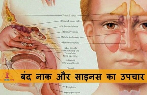 ऐसे करें बंद नाक और साइनस का रामबाण उपचार