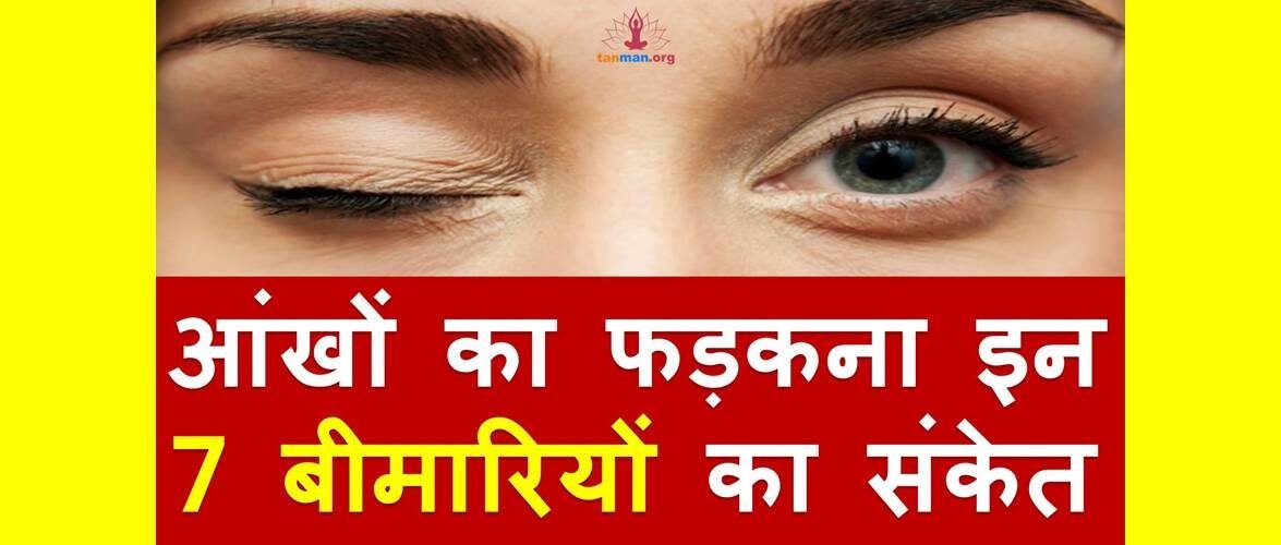 बार बार फड़कती हैं आंखें तो हो जाएं सावधान, यह हो सकता है इन 7 गंभीर बीमारियों का इशारा