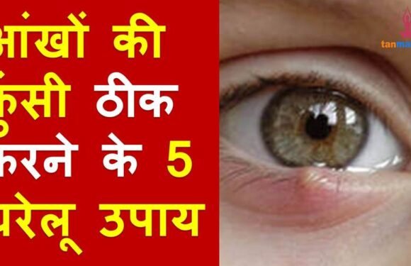 इन 5 असरदार घरेलू उपायों से ठीक करें आंखों की फुंसी