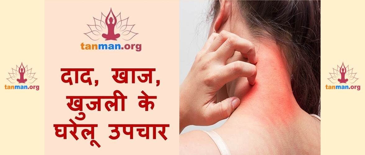 दाद खाज खुजली से छुटकारा पाने के लिए 5 सबसे चमत्कारिक घरेलू उपचार