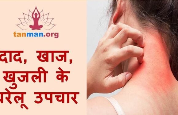 दाद खाज खुजली से छुटकारा पाने के लिए 5 सबसे चमत्कारिक घरेलू उपचार