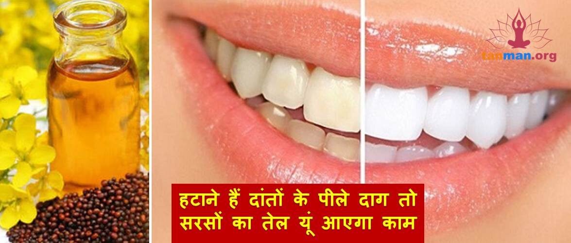 हटाने हैं दांतों के पीले दाग तो सरसों का तेल यूं आएगा काम