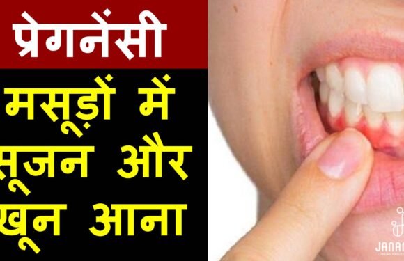 मसूड़ों से खून रोकने के 8 असरदार घरेलू तरीके