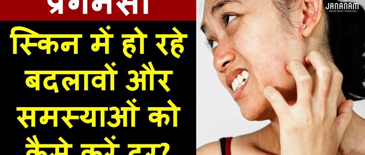 प्रेगनेंसी के दौरान त्वचा से जुड़ी समस्याओं को कैसे करें दूर?