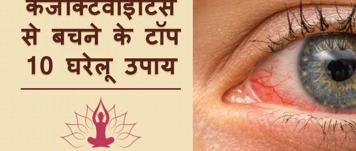कंजंक्टिवाइटिस का इलाज और 10 घरेलू उपाय