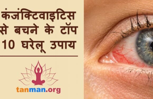 कंजंक्टिवाइटिस का इलाज और 10 घरेलू उपाय