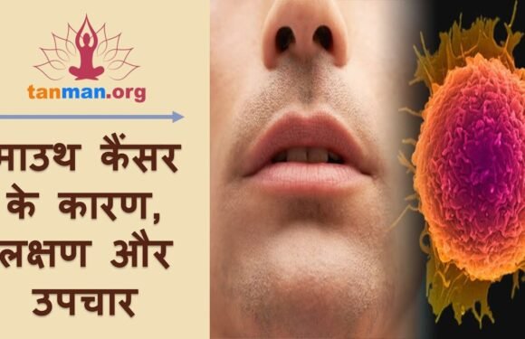 मुंह के कैंसर के शुरुआती लक्षण, कारण और इलाज