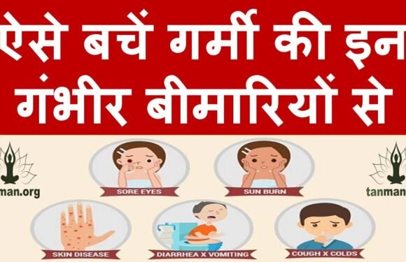 ऐसे बचें गर्मी की इन 4 बीमारियों से
